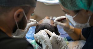 頭皮のニオイを解消するための効果的なスカルプ対策は？